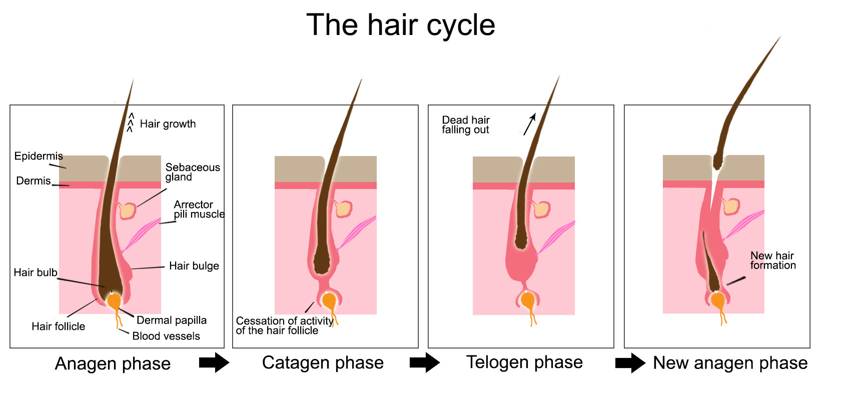 Alopecia – Telogen Effluvium – Appalachian Spring Dermatology